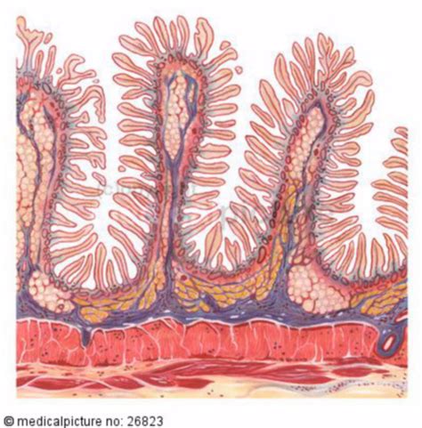 Esquema del intestino delgado con vellosidades sanas y atrofiadas por la celiaquía