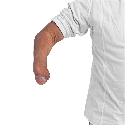 Persona con un brazo con cortes falsos hechos con maquillaje