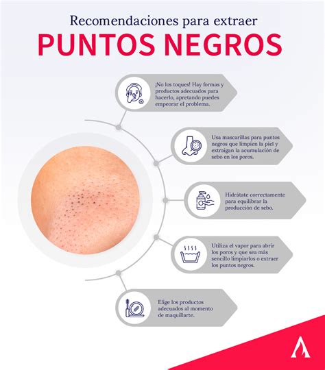 infografía sobre la formación de puntos negros en la piel
