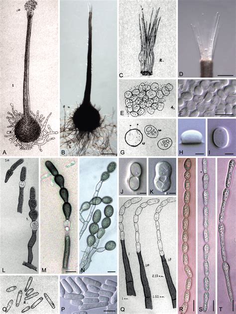 Investigadores Lina Quesada-Ocampo y Camilo Parada-Rojas examinando un cultivo puro del hongo Ceratocystis fimbriata en una placa de agar