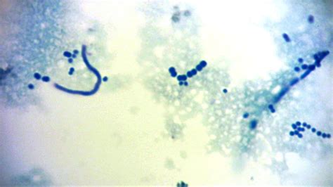 Comunidades de bacterias productoras de yogur observadas al microscopio, mostrando cadenas de cocos y bacilos teñidos con Azul de metileno.