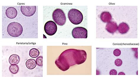 Granos de polen de pino carrasco observados al microscopio, destacando los sacos aeríferos.