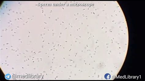 Espermatozoides de cerdo observados al microscopio, teñidos con Azul de metileno.