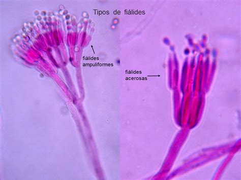 Conidióforos y esporas de Penicillium sp. observados al microscopio.