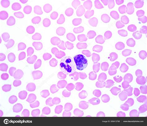 Frotis de sangre humana al microscopio, mostrando glóbulos rojos, glóbulos blancos y plaquetas.