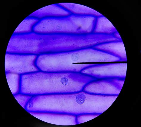 Microfotografía de epidermis de cebolla teñida con Lugol a 40X, mostrando los núcleos teñidos.