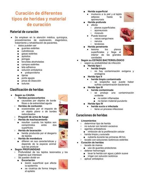 Infografía comparativa entre los tipos de curación: artesanal, acaramelado y colonial.