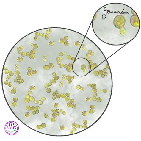 Micrografía de levaduras en una muestra de carne deteriorada
