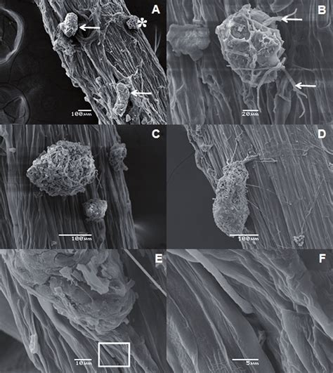 Microfotografía de microesclerocios de Macrophomina phaseolina en tejido vegetal.