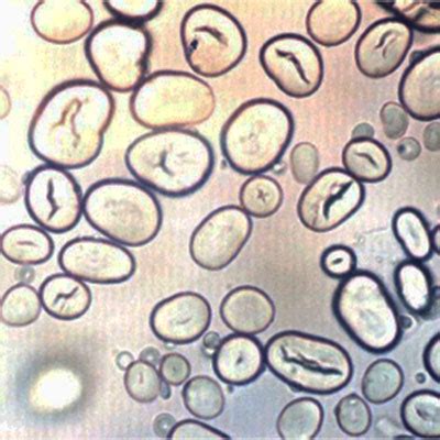 micrografía de gránulos de almidón de trigo