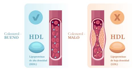 Infografía detallando los tipos de colesterol (LDL, HDL, VLDL) y su impacto en la salud cardiovascular.