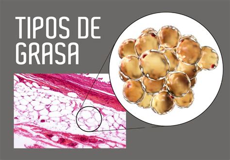 Diagrama ilustrando las zonas de una parrilla a gas y dónde se acumula la grasa que puede causar llamaradas.