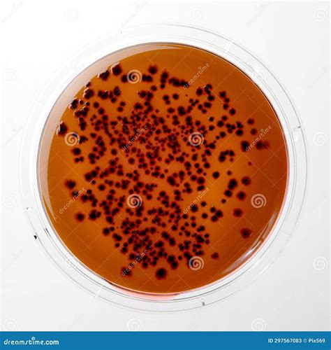 Placa de Petri mostrando colonias de Salmonella spp. en Agar Verde Brillante