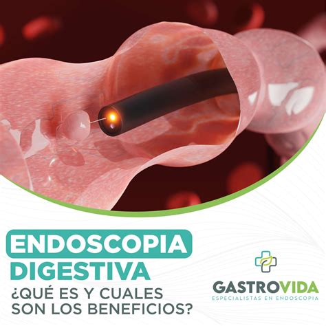 Imagen de endoscopia mostrando un objeto extraño en el estómago