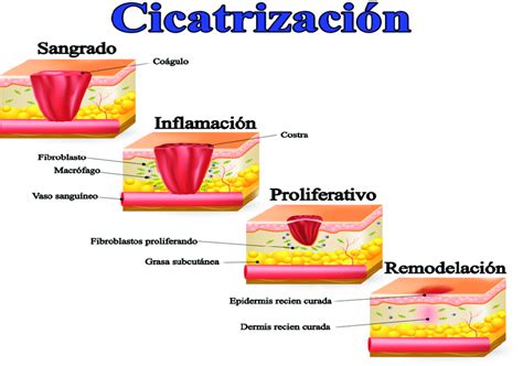 Esquema visual de las etapas de cicatrización de un piercing y cómo limpiarlo correctamente.