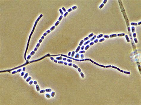 Microscopía de Geotrichum candidum mostrando artroconidias