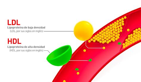 Esquema de las lipoproteínas LDL y HDL y su función en el cuerpo