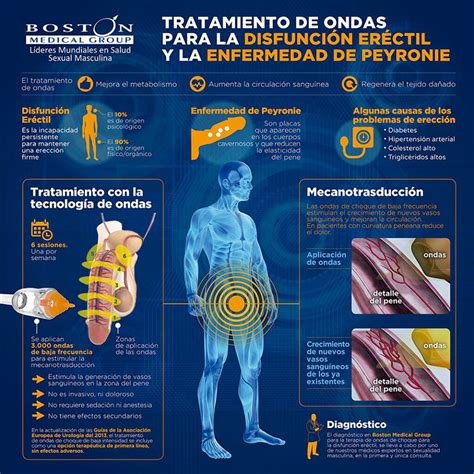Esquema de las causas y tratamientos de la disfunción eréctil