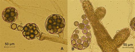 Microfotografía de Saprolegnia parasitica en ovas de salmón
