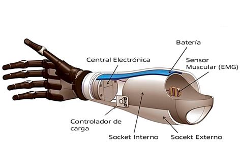 Esquema de una prótesis biónica de brazo, mostrando componentes internos y externos