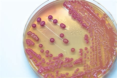 Micrografía de colonias bacterianas en un medio de cultivo agar.