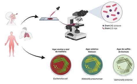 Esquema del proceso de diagnóstico de infecciones fúngicas, desde la toma de muestra hasta el cultivo y el análisis microscópico