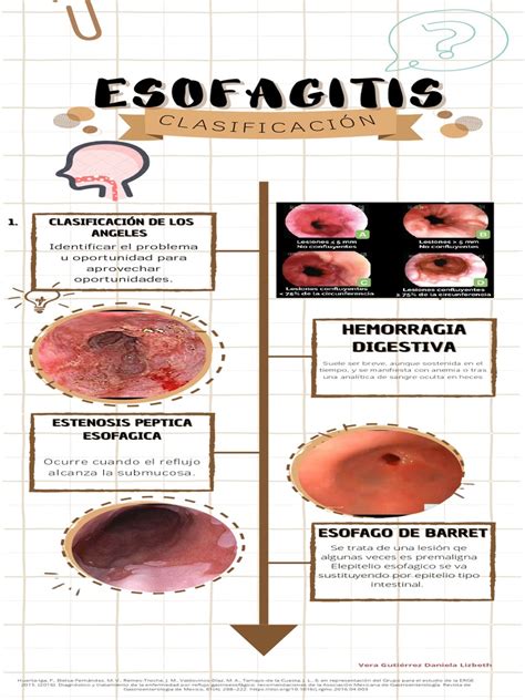 Diagrama que ilustra los diferentes tipos de esofagitis y sus causas.