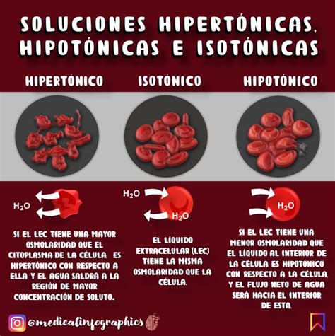 Infografía comparando soluciones hipotónicas, hipertónicas e isotónicas