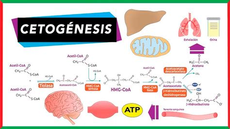 infografía sobre el proceso de cetosis y sus desencadenantes