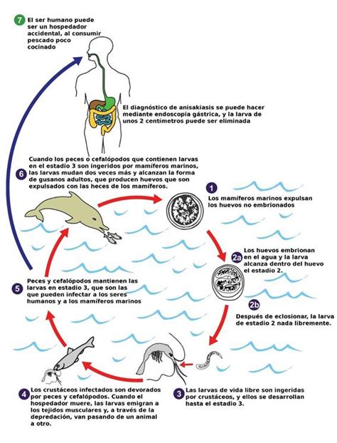Esquema sobre el ciclo de vida del Anisakis y su impacto en la mucosa gástrica humana.