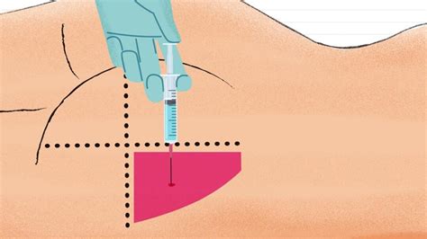 Ilustración técnica de cómo aplicar un diseño bajo cubierta utilizando una plantilla sobre una pieza de bizcocho.