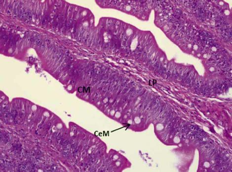 Microfotografía del intestino anterior de Merluccius australis (H&E, 200X), mostrando la capa mucosa (CM) con epitelio columnar y presencia de escasa cantidad de células mucosas (CeM) de gran tamaño, y una delgada lámina propia (LP) en las vellosidades intestinales.