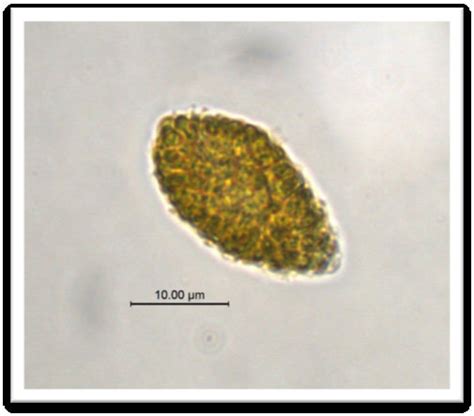 Microfotografía de células de Chattonella spp.