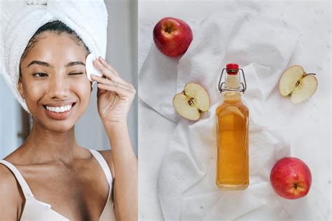 ilustración mostrando diferentes formas de aplicar vinagre de manzana en la piel