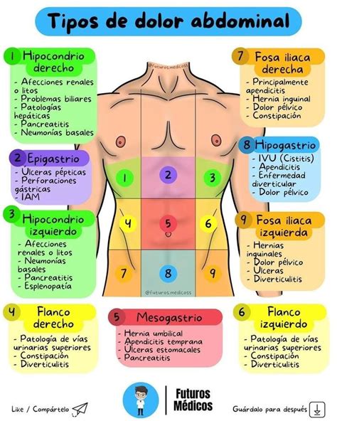 Infografía detallando los diferentes tipos de dolor abdominal y sus posibles localizaciones