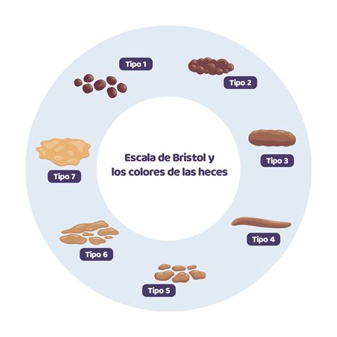 Representación visual de la Escala de Heces de Bristol con sus siete tipos.