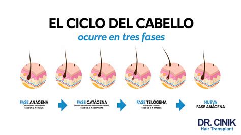 Infografía que muestra el ciclo de crecimiento del cabello normal vs. el ciclo afectado por DHT en SOP
