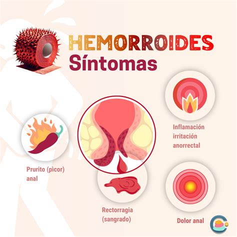 Infografía detallando las causas comunes de sangrado rectal, como hemorroides, fisuras anales y pólipos.