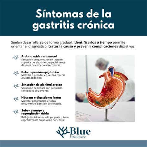 Infografía: principales causas de malestar estomacal y síntomas comunes (gastritis, reflujo, gases)