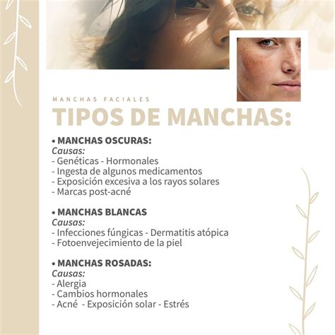 Esquema explicativo que muestra las causas principales de las manchas faciales: radiación solar, cambios hormonales y estrés oxidativo.