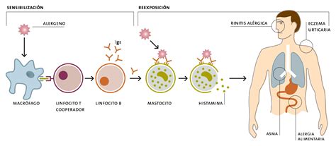 Esquema de respuesta alérgica en el cuerpo humano