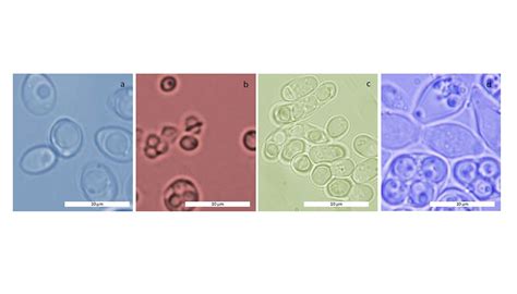 Ilustración de diferentes tipos de levaduras observadas bajo microscopio, destacando sus formas y tamaños variados.