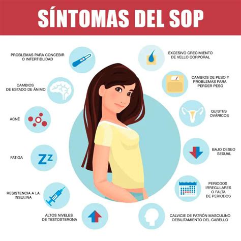 Ilustración de los diversos síntomas del SOP