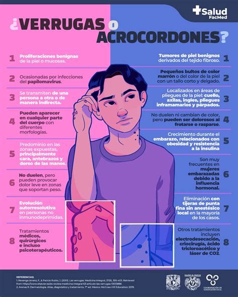 Esquema comparativo de acrocordones y verrugas genitales
