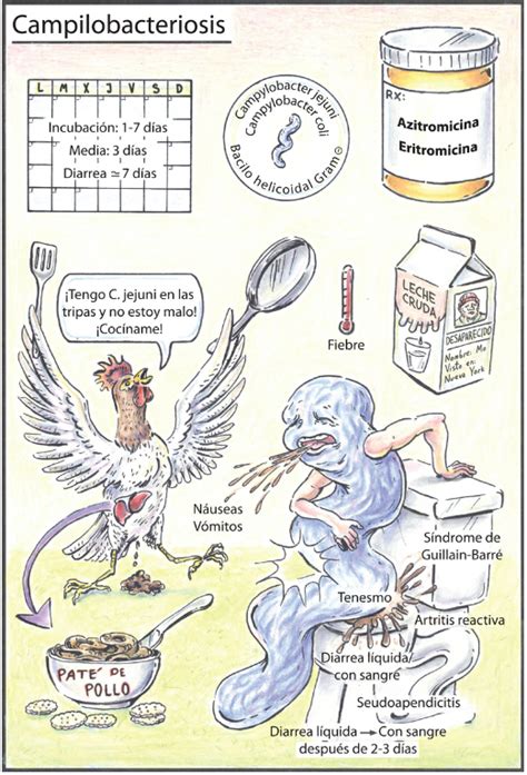 Diagrama explicando la relación entre la infección por Campylobacter y el Síndrome de Guillain-Barré.