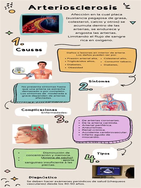 Infografía sobre la aterosclerosis y el flujo sanguíneo