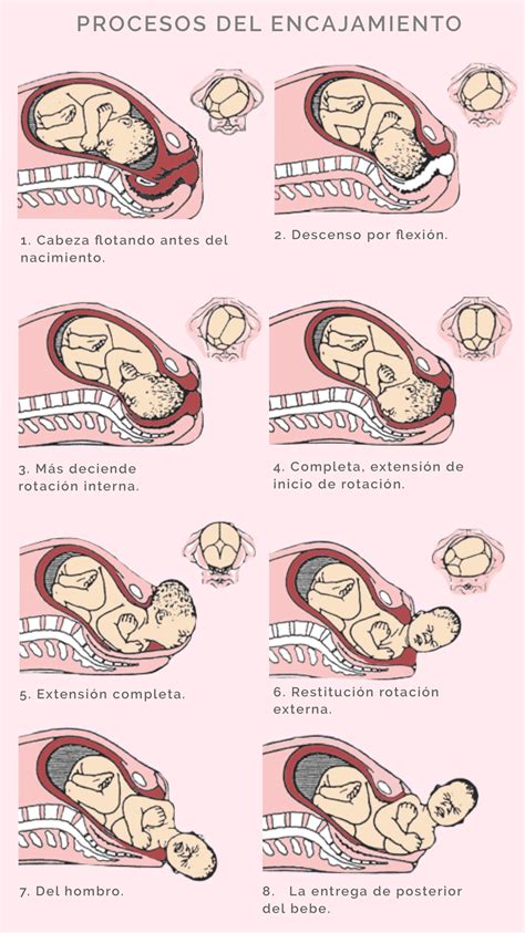 Infografía que muestra el proceso de encajamiento del bebé en la pelvis materna.