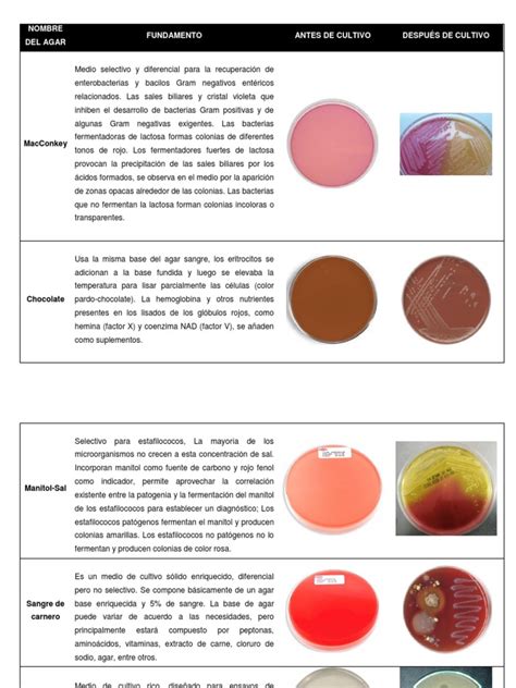 Infografía comparativa que muestra los diferentes tipos de agares (MacConkey, Sangre, Sabouraud) y sus usos específicos para aislar bacterias u hongos.