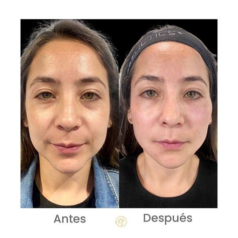 collage de fotos de antes y después de aplicación de tinte Ilicit tono chocolate