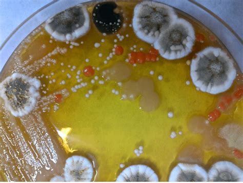 Micrografía de levaduras y mohos creciendo en un medio de cultivo selectivo